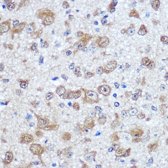 Immunohistochemistry: ELAVL4 Antibody [NBP3-35160] - Immunohistochemistry analysis of paraffin-embedded Mouse brain using ELAVL4 Rabbit pAb at dilution of 1:100 (40x lens). Microwave antigen retrieval performed with 0.01M PBS Buffer (pH 7.2) prior to IHC staining.