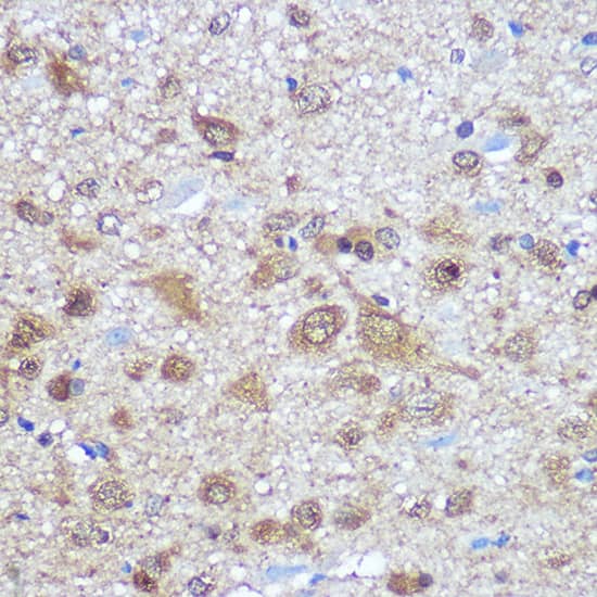 Immunohistochemistry: ELAVL4 Antibody [NBP3-35160] - Immunohistochemistry analysis of paraffin-embedded Rat brain using ELAVL4 Rabbit pAb at dilution of 1:100 (40x lens). Microwave antigen retrieval performed with 0.01M PBS Buffer (pH 7.2) prior to IHC staining.