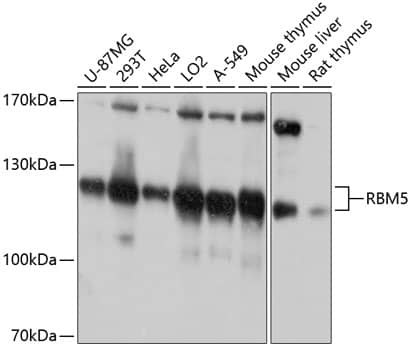 Western Blot: RBM5 Antibody [NBP3-35162] - Western blot analysis of various lysates using RBM5 Rabbit pAb at 1:1000 dilution.Secondary antibody: HRP-conjugated Goat anti-Rabbit IgG (H+L) at 1:10000 dilution.Lysates/proteins: 25ug per lane.Blocking buffer: 3% nonfat dry milk in TBST.Detection: ECL Basic Kit.Exposure time: 30s.