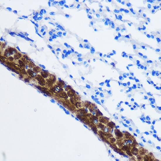Immunohistochemistry: Protein Phosphatase 1 beta Antibody [NBP3-35163] - Immunohistochemistry analysis of paraffin-embedded Mouse lung using Protein Phosphatase 1 beta Rabbit pAb at dilution of 1:100 (40x lens). Microwave antigen retrieval performed with 0.01M PBS Buffer (pH 7.2) prior to IHC staining.