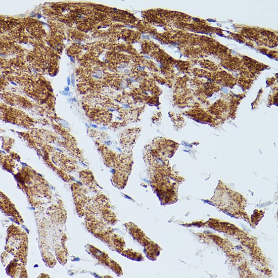 Immunohistochemistry: SERCA2 ATPase Antibody [NBP3-35164] - Immunohistochemistry analysis of paraffin-embedded Mouse heart using SERCA2 ATPase Rabbit pAb at dilution of 1:20 (40x lens). High pressure antigen retrieval performed with 0.01M Citrate Bufferr (pH 6.0) prior to IHC staining.