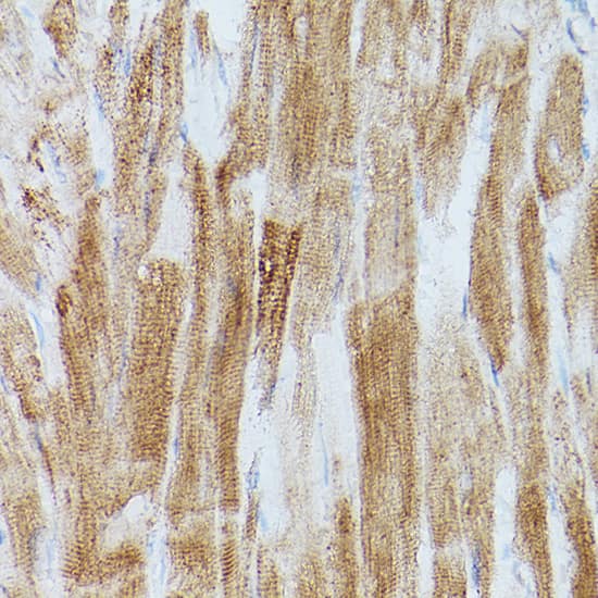 Immunohistochemistry: SERCA2 ATPase Antibody [NBP3-35164] - Immunohistochemistry analysis of paraffin-embedded Rat heart using SERCA2 ATPase Rabbit pAb at dilution of 1:20 (40x lens). High pressure antigen retrieval performed with 0.01M Citrate Bufferr (pH 6.0) prior to IHC staining.