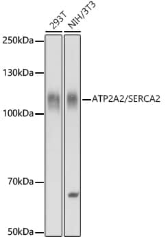 Western Blot: SERCA2 ATPase Antibody [NBP3-35164] - Western blot analysis of various lysates using SERCA2 ATPase Rabbit pAb at 1:10000 dilution.Secondary antibody: HRP-conjugated Goat anti-Rabbit IgG (H+L) at 1:10000 dilution.Lysates/proteins: 25ug per lane.Blocking buffer: 3% nonfat dry milk in TBST.Detection: ECL Basic Kit.Exposure time: 10s.