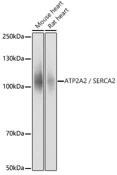 Western Blot: SERCA2 ATPase Antibody [NBP3-35164] - Western blot analysis of various lysates using SERCA2 ATPase Rabbit pAb at 1:10000 dilution.Secondary antibody: HRP-conjugated Goat anti-Rabbit IgG (H+L) at 1:10000 dilution.Lysates/proteins: 25ug per lane.Blocking buffer: 3% nonfat dry milk in TBST.Detection: ECL Basic Kit.Exposure time: 1s.