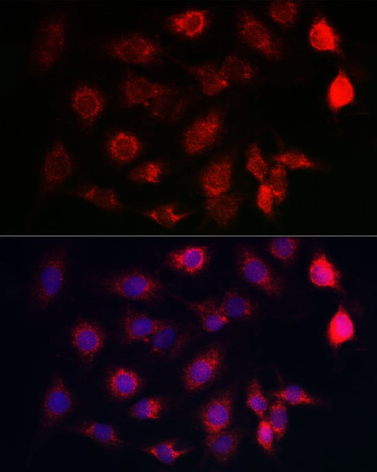 Immunocytochemistry/ Immunofluorescence: SERCA2 ATPase Antibody [NBP3-35164] - Immunofluorescence analysis of C6 cells using SERCA2 ATPase Rabbit pAb at dilution of 1:100 (40x lens). Secondary antibody: Cy3-conjugated Goat anti-Rabbit IgG (H+L) at 1:500 dilution. Blue: DAPI for nuclear staining.