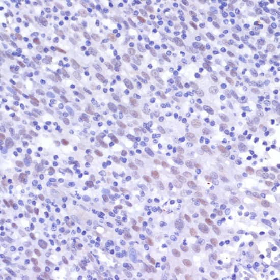 Immunohistochemistry: NFkB p105/p50 Antibody [NBP3-35166] - Immunohistochemistry analysis of paraffin-embedded Human tonsil using NFkB p105/p50 Rabbit pAb at dilution of 1:200 (40x lens). Microwave antigen retrieval performed with 0.01M PBS Buffer (pH 7.2) prior to IHC staining.