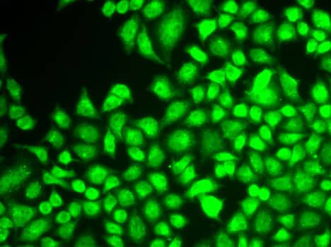 Immunocytochemistry/ Immunofluorescence: NFkB p105/p50 Antibody [NBP3-35166] - Immunofluorescence analysis of MCF7 cells using NFkB p105/p50 Rabbit pAb.Secondary antibody: Cy3-conjugated Goat anti-Rabbit IgG (H+L) at 1:500 dilution.