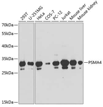 Western Blot: PSMA4 Antibody [NBP3-35169] - Western blot analysis of various lysates using PSMA4 Rabbit pAb at 1:1000 dilution.Secondary antibody: HRP-conjugated Goat anti-Rabbit IgG (H+L) at 1:10000 dilution.Lysates/proteins: 25ug per lane.Blocking buffer: 3% nonfat dry milk in TBST.