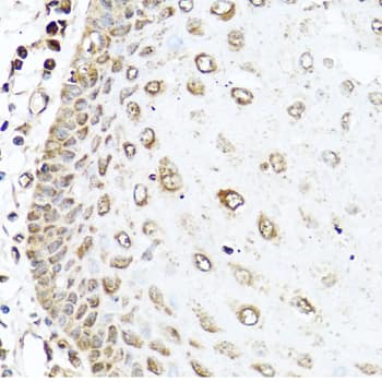 Immunohistochemistry RAC2 Antibody