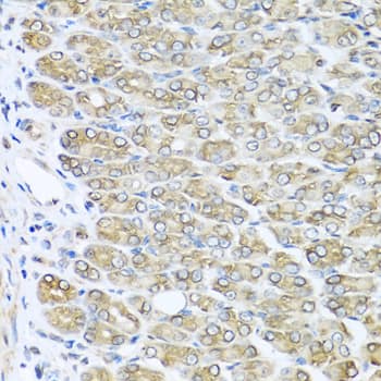 Immunohistochemistry: RAC2 Antibody [NBP3-35170] - Immunohistochemistry analysis of paraffin-embedded Mouse stomach using RAC2 Rabbit pAb at dilution of 1:100 (40x lens). Microwave antigen retrieval performed with 0.01M PBS Buffer (pH 7.2) prior to IHC staining.