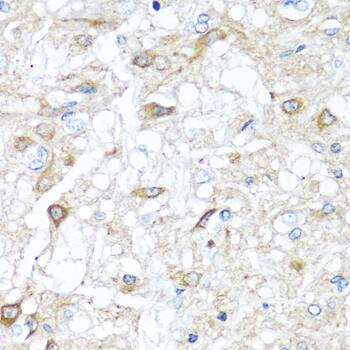 Immunohistochemistry RAC2 Antibody