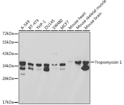 Western Blot Tropomyosin-1 Antibody