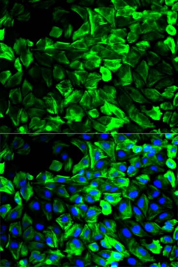 Immunocytochemistry/ Immunofluorescence: Tropomyosin-1 Antibody [NBP3-35171] - Immunofluorescence analysis of HeLa cells using Tropomyosin-1 Rabbit pAb. Secondary antibody: Cy3-conjugated Goat anti-Rabbit IgG (H+L) at 1:500 dilution. Blue: DAPI for nuclear staining.