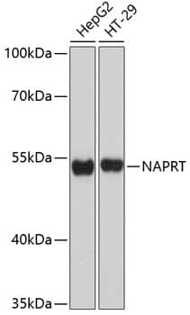 Western Blot: NAPRT1 Antibody [NBP3-35172] - Western blot analysis of various lysates using NAPRT1 Rabbit pAb at 1:3000 dilution.Secondary antibody: HRP-conjugated Goat anti-Rabbit IgG (H+L) at 1:10000 dilution.Lysates/proteins: 25ug per lane.Blocking buffer: 3% nonfat dry milk in TBST.Detection: ECL Basic Kit.Exposure time: 30s.