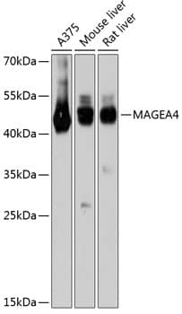 Western Blot: MAGEA4 Antibody [NBP3-35173] - Western blot analysis of various lysates using MAGEA4 Rabbit pAb at 1:3000 dilution.Secondary antibody: HRP-conjugated Goat anti-Rabbit IgG (H+L) at 1:10000 dilution.Lysates/proteins: 25ug per lane.Blocking buffer: 3% nonfat dry milk in TBST.Detection: ECL Basic Kit.Exposure time: 10s.