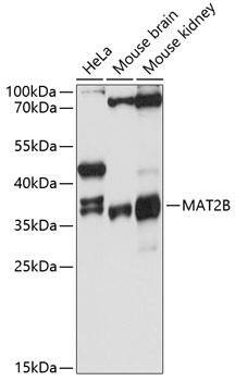 Western Blot: MAT2B Antibody [NBP3-35174] - Western blot analysis of various lysates using MAT2B Rabbit pAb at 1:3000 dilution.Secondary antibody: HRP-conjugated Goat anti-Rabbit IgG (H+L) at 1:10000 dilution.Lysates/proteins: 25ug per lane.Blocking buffer: 3% nonfat dry milk in TBST.Detection: ECL Basic Kit.Exposure time: 30s.