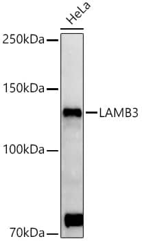 Western Blot: Laminin beta 3 Antibody [NBP3-35175] - Western blot analysis of lysates from HeLa cells, using Laminin beta 3 Rabbit pAb at  1:500 dilution.Secondary antibody: HRP-conjugated Goat anti-Rabbit IgG (H+L) at 1:10000 dilution.Lysates/proteins: 25ug per lane.Blocking buffer: 3% nonfat dry milk in TBST.Detection: ECL Basic Kit.Exposure time: 180s.