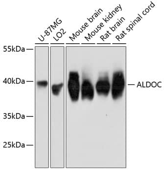 Western Blot: Aldolase C Antibody [NBP3-35176] - Western blot analysis of various lysates using Aldolase C Rabbit pAb at 1:3000 dilution.Secondary antibody: HRP-conjugated Goat anti-Rabbit IgG (H+L) at 1:10000 dilution.Lysates/proteins: 25ug per lane.Blocking buffer: 3% nonfat dry milk in TBST.Detection: ECL Basic Kit.Exposure time: 3s.