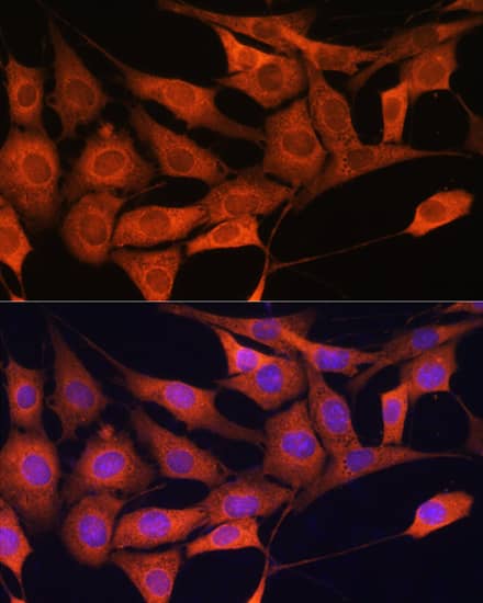 Immunocytochemistry/ Immunofluorescence: Aldolase C Antibody [NBP3-35176] - Immunofluorescence analysis of NIH/3T3 cells using Aldolase C Rabbit pAb at dilution of 1:100. Secondary antibody: Cy3-conjugated Goat anti-Rabbit IgG (H+L) at 1:500 dilution. Blue: DAPI for nuclear staining.