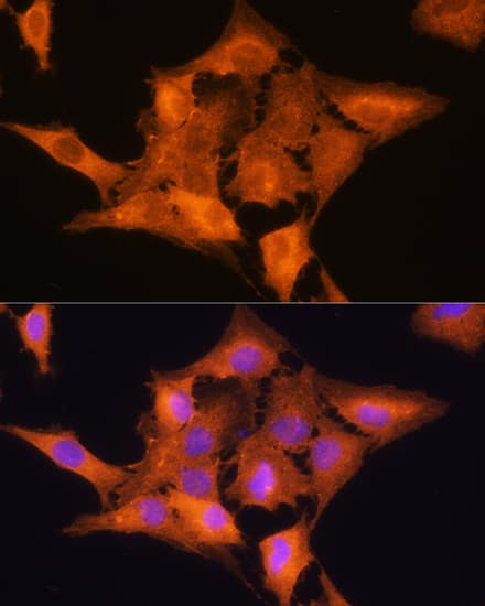 Immunocytochemistry/ Immunofluorescence: Aldolase C Antibody [NBP3-35176] - Immunofluorescence analysis of C6 cells using Aldolase C Rabbit pAb at dilution of 1:100. Secondary antibody: Cy3-conjugated Goat anti-Rabbit IgG (H+L) at 1:500 dilution. Blue: DAPI for nuclear staining.