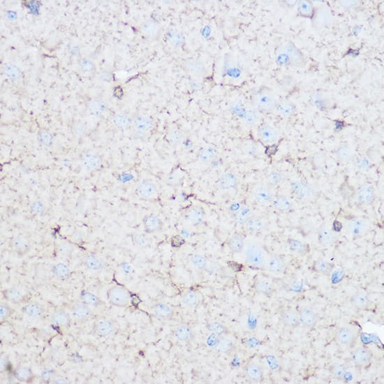 Immunohistochemistry: Aldolase C Antibody [NBP3-35176] - Immunohistochemistry analysis of paraffin-embedded Mouse brain using Aldolase C Rabbit pAb at dilution of 1:100 (40x lens). Microwave antigen retrieval performed with 0.01M Tris/EDTA Buffer (pH 9.0) prior to IHC staining.