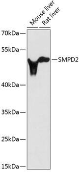 Western Blot nSMase Antibody