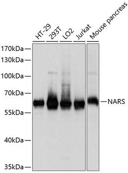 Western Blot NARS Antibody