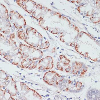 Immunohistochemistry: ACSL3 Antibody [NBP3-35183] - Immunohistochemistry analysis of paraffin-embedded Human stomach using ACSL3 Rabbit pAb at dilution of 1:100 (40x lens). Microwave antigen retrieval performed with 0.01M PBS Buffer (pH 7.2) prior to IHC staining.