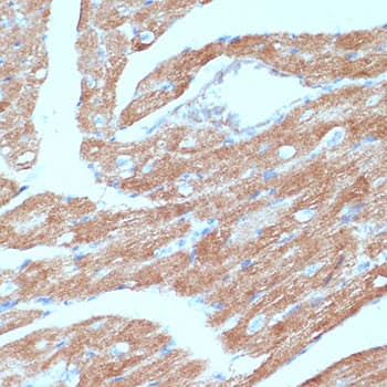Immunohistochemistry: ACSL3 Antibody [NBP3-35183] - Immunohistochemistry analysis of paraffin-embedded Mouse heart using ACSL3 Rabbit pAb at dilution of 1:100 (40x lens). Microwave antigen retrieval performed with 0.01M PBS Buffer (pH 7.2) prior to IHC staining.