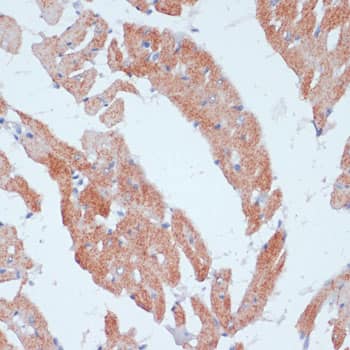 Immunohistochemistry: ACSL3 Antibody [NBP3-35183] - Immunohistochemistry analysis of paraffin-embedded Rat heart using ACSL3 Rabbit pAb at dilution of 1:100 (40x lens). Microwave antigen retrieval performed with 0.01M PBS Buffer (pH 7.2) prior to IHC staining.