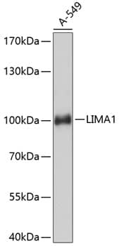 Western Blot: EPLIN Antibody [NBP3-35184] - Western blot analysis of lysates from A-549 cells, using EPLIN Rabbit pAb at 1:3000 dilution.Secondary antibody: HRP-conjugated Goat anti-Rabbit IgG (H+L) at 1:10000 dilution.Lysates/proteins: 25ug per lane.Blocking buffer: 3% nonfat dry milk in TBST.Detection: ECL Basic Kit.Exposure time: 10s.