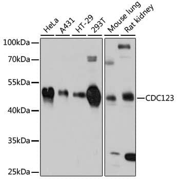 Western Blot: CDC123 Antibody [NBP3-35185] - Western blot analysis of various lysates using CDC123 Rabbit pAb at 1:3000 dilution.Secondary antibody: HRP-conjugated Goat anti-Rabbit IgG (H+L) at 1:10000 dilution.Lysates/proteins: 25ug per lane.Blocking buffer: 3% nonfat dry milk in TBST.Detection: ECL Basic Kit.Exposure time: 10s.