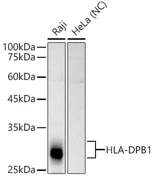 Western Blot: HLA DPB1 Antibody [NBP3-35186] - Western blot analysis of various lysates, using HLA DPB1 Rabbit pAb at 1:1000 dilution.Secondary antibody: HRP-conjugated Goat anti-Rabbit IgG (H+L) at 1:10000 dilution.Lysates/proteins: 25ug per lane.Blocking buffer: 3% nonfat dry milk in TBST.Detection: ECL Basic Kit.Negative control (NC): HeLaExposure time: 10s.