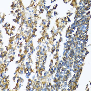 Immunohistochemistry: HLA DPB1 Antibody [NBP3-35186] - Immunohistochemistry analysis of paraffin-embedded Human lymphonodus using HLA DPB1 Rabbit pAb at dilution of 1:100 (40x lens). Microwave antigen retrieval performed with 0.01M PBS Buffer (pH 7.2) prior to IHC staining.