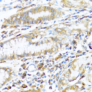 Immunohistochemistry: HLA DPB1 Antibody [NBP3-35186] - Immunohistochemistry analysis of paraffin-embedded Human stomach using HLA DPB1 Rabbit pAb at dilution of 1:100 (40x lens). Microwave antigen retrieval performed with 0.01M PBS Buffer (pH 7.2) prior to IHC staining.