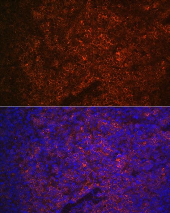 Immunocytochemistry/ Immunofluorescence: P2X5/P2RX5 Antibody [NBP3-35187] - Immunofluorescence analysis of paraffin-embedded mouse spleen using P2X5/P2RX5 Rabbit pAb at dilution of 1:100 (40x lens). Secondary antibody: Cy3-conjugated Goat anti-Rabbit IgG (H+L) at 1:500 dilution. Blue: DAPI for nuclear staining.