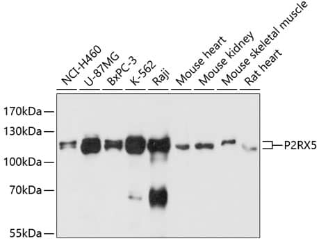 Western Blot: P2X5/P2RX5 Antibody [NBP3-35187] - Western blot analysis of various lysates using P2X5/P2RX5 Rabbit pAb at 1:3000 dilution.Secondary antibody: HRP-conjugated Goat anti-Rabbit IgG (H+L) at 1:10000 dilution.Lysates/proteins: 25ug per lane.Blocking buffer: 3% nonfat dry milk in TBST.Detection: ECL Basic Kit.Exposure time: 10s.