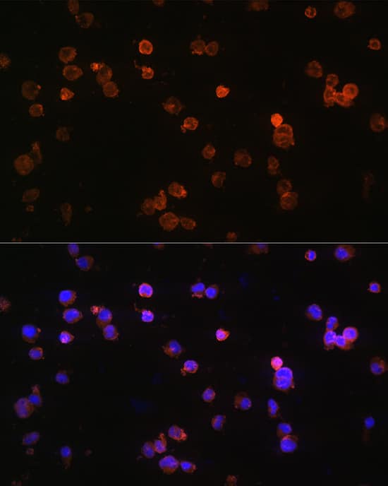 Immunocytochemistry/ Immunofluorescence: P2X5/P2RX5 Antibody [NBP3-35187] - Immunofluorescence analysis of Jurkat cells using P2X5/P2RX5 Rabbit pAb at dilution of 1:100 (40x lens). Secondary antibody: Cy3-conjugated Goat anti-Rabbit IgG (H+L) at 1:500 dilution. Blue: DAPI for nuclear staining.