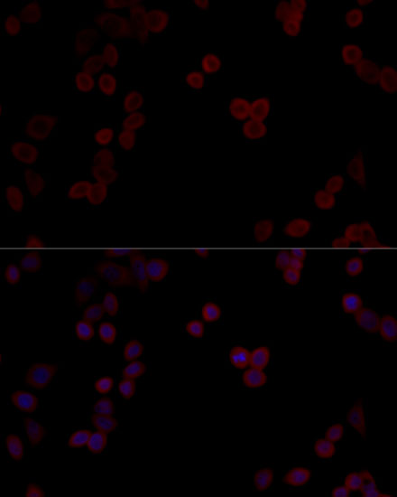 Immunocytochemistry/ Immunofluorescence: PP5 Antibody [NBP3-35188] - Immunofluorescence analysis of HeLa cells using PP5 Rabbit pAb at dilution of 1:100 (40x lens). Secondary antibody: Cy3 Goat Anti-Rabbit IgG (H+L) at 1:500 dilution. Blue: DAPI for nuclear staining.