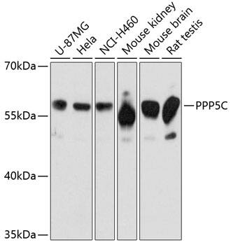 Western Blot: PP5 Antibody [NBP3-35188] - Western blot analysis of various lysates using PP5 Rabbit pAb at 1:3000 dilution.Secondary antibody: HRP-conjugated Goat anti-Rabbit IgG (H+L) at 1:10000 dilution.Lysates/proteins: 25ug per lane.Blocking buffer: 3% nonfat dry milk in TBST.Detection: ECL Basic Kit.Exposure time: 60s.