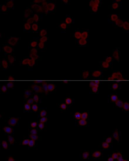 Immunocytochemistry/ Immunofluorescence: PP5 Antibody [NBP3-35188] - Immunofluorescence analysis of HeLa cells using PP5 Rabbit pAb at dilution of 1:100 (40x lens). Secondary antibody: Cy3-conjugated Goat anti-Rabbit IgG (H+L) at 1:500 dilution. Blue: DAPI for nuclear staining.