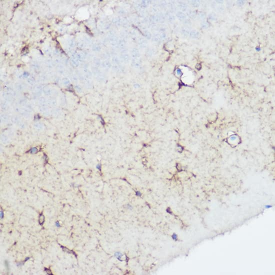 Immunohistochemistry: Calpain 1 Antibody [NBP3-35190] - Immunohistochemistry analysis of paraffin-embedded Rat brain using Calpain 1 Rabbit pAb at dilution of 1:100 (40x lens). High pressure antigen retrieval performed with 0.01M Citrate Bufferr (pH 6.0) prior to IHC staining.