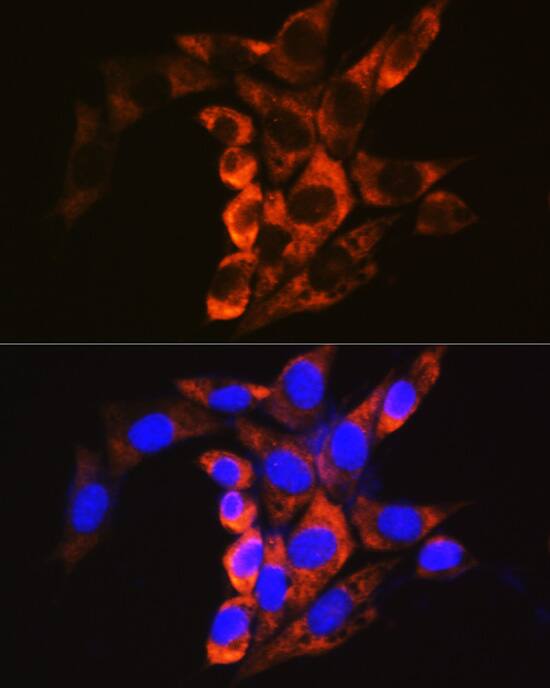 Immunocytochemistry/ Immunofluorescence: Calpain 1 Antibody [NBP3-35190] - Immunofluorescence analysis of NIH/3T3 cells using Calpain 1 Rabbit pAb at dilution of 1:100. Secondary antibody: Cy3-conjugated Goat anti-Rabbit IgG (H+L) at 1:500 dilution. Blue: DAPI for nuclear staining.