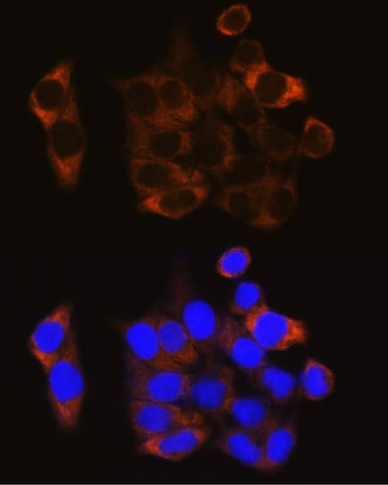 Immunocytochemistry/ Immunofluorescence: Calpain 1 Antibody [NBP3-35190] - Immunofluorescence analysis of HeLa cells using Calpain 1 Rabbit pAb at dilution of 1:100. Secondary antibody: Cy3-conjugated Goat anti-Rabbit IgG (H+L) at 1:500 dilution. Blue: DAPI for nuclear staining.