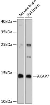 Western Blot: AKAP7 Antibody [NBP3-35191] - Western blot analysis of various lysates using AKAP7 Rabbit pAb at 1:3000 dilution.Secondary antibody: HRP-conjugated Goat anti-Rabbit IgG (H+L) at 1:10000 dilution.Lysates/proteins: 25ug per lane.Blocking buffer: 3% nonfat dry milk in TBST.Detection: ECL Basic Kit.Exposure time: 90s.