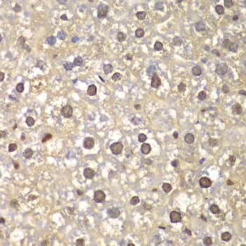 Immunohistochemistry: FEN-1 Antibody [NBP3-35193] - Immunohistochemistry analysis of paraffin-embedded Mouse liver using FEN-1 Rabbit pAb at dilution of 1:100 (40x lens). Microwave antigen retrieval performed with 0.01M PBS Buffer (pH 7.2) prior to IHC staining.