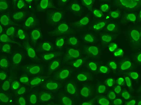 Immunocytochemistry/ Immunofluorescence: FEN-1 Antibody [NBP3-35193] - Immunofluorescence analysis of HeLa cells using FEN-1 Rabbit pAb.Secondary antibody: Cy3-conjugated Goat anti-Rabbit IgG (H+L) at 1:500 dilution.