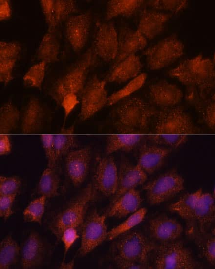 Immunocytochemistry/ Immunofluorescence: SMYD3 Antibody [NBP3-35194] - Immunofluorescence analysis of C6 cells using SMYD3 Rabbit pAb at dilution of 1:100. Secondary antibody: Cy3-conjugated Goat anti-Rabbit IgG (H+L) at 1:500 dilution. Blue: DAPI for nuclear staining.