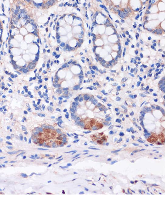 Immunohistochemistry: SMYD3 Antibody [NBP3-35194] - Immunohistochemistry analysis of paraffin-embedded Human colon using SMYD3 Rabbit pAb at dilution of 1:100 (40x lens). Microwave antigen retrieval performed with 0.01M PBS Buffer (pH 7.2) prior to IHC staining.