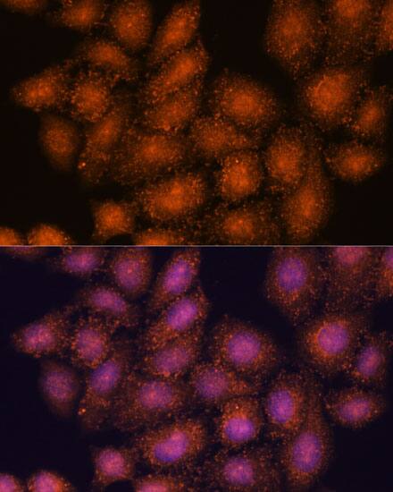 Immunocytochemistry/ Immunofluorescence: SMYD3 Antibody [NBP3-35194] - Immunofluorescence analysis of HeLa cells using SMYD3 Rabbit pAb at dilution of 1:100. Secondary antibody: Cy3-conjugated Goat anti-Rabbit IgG (H+L) at 1:500 dilution. Blue: DAPI for nuclear staining.